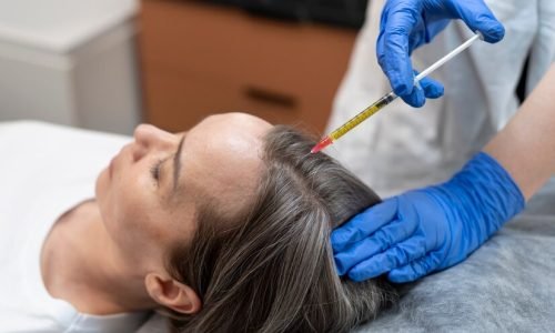 high-angle-patient-getting-prp-injection-alopecia_23-2149341421.jpg high-angle-patient-getting-prp-injection-alopecia_23-2149341421.jpg