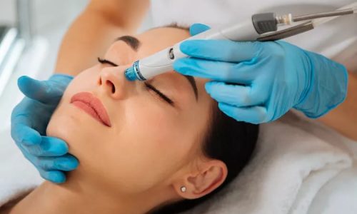 Hydrafacial