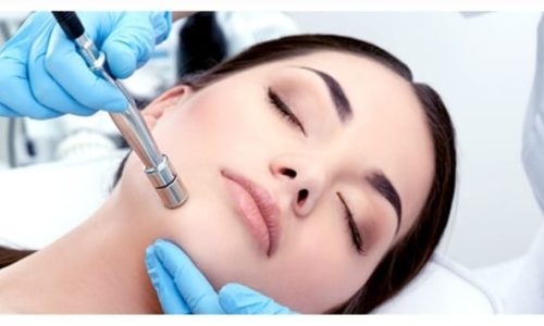 Microdermabrasion