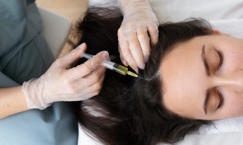 top-view-healthcare-professional-injecting-scalp_23-2149404730